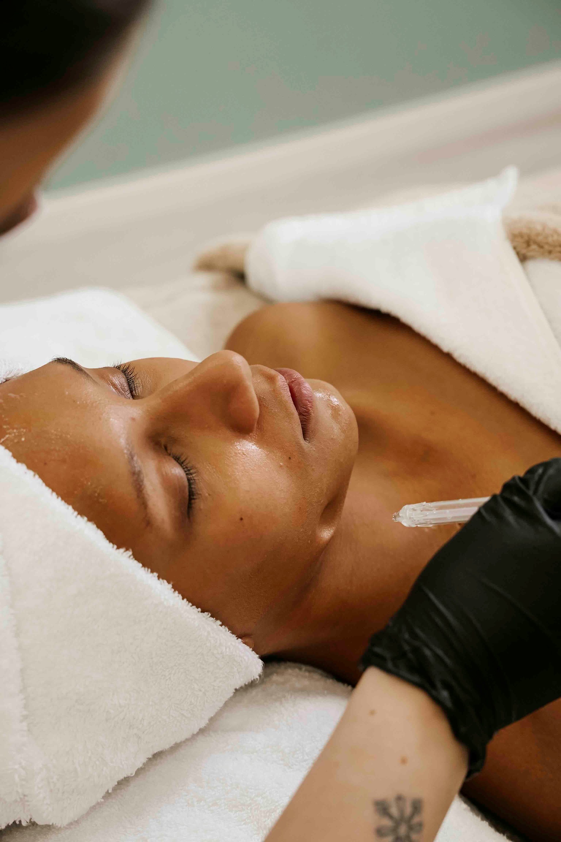 JetPeel Gesichtsbehandlung für Bräute in München – Wirkstoff-Infusion ohne Nadeln